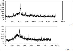 Click here to view Large Figure 4 Lupinepublishers-openaccess-cancer-Oncology