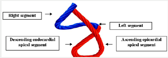 Click here to view Large Scheme 1 Lupinepublishers-openaccess-cardiology