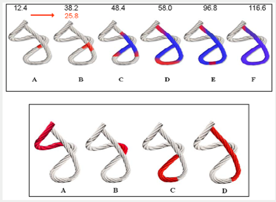 Click here to view Large Scheme 1 Lupinepublishers-openaccess-cardiology