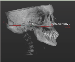 Click here to view Large Figure 1 Lupinepublishers-openaccess-dentistry-oral-healthcare