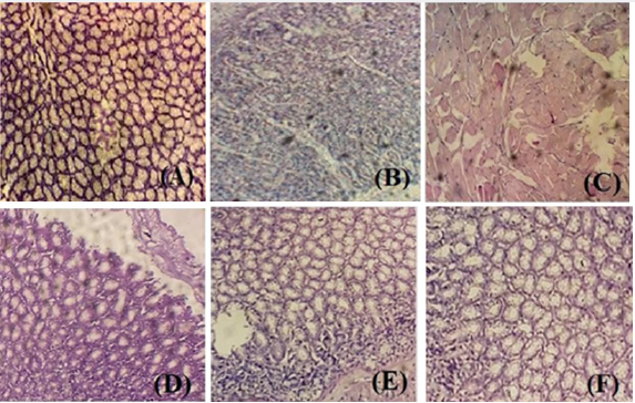 Click here to view Large Figure 2 lupinepublishers-openaccess-journal-gastroenterology-hepatology