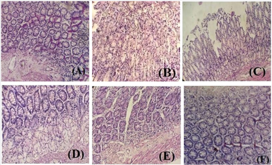 Click here to view Large Figure 4 lupinepublishers-openaccess-journal-gastroenterology-hepatology