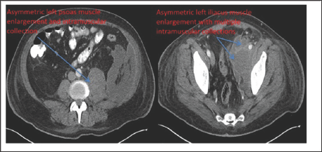 Click here to view Large Figure 2 Lupinepublishers-openaccess-Ophthalmology