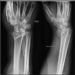 Click here to view Large Figure 1