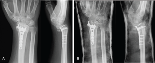 Click here to view Large Figure 2