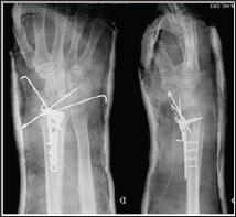 Click here to view Large Figure 3