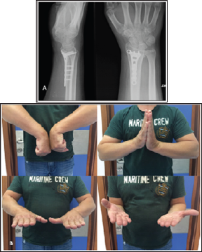 Click here to view Large Figure 4