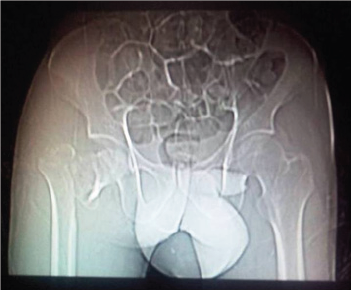 Click here to view Large Figure 1