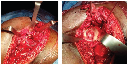 Click here to view Large Figure 3c