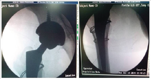 Click here to view Large Figure 3d