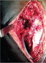 Click here to view Large Figure 3e