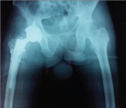 Click here to view Large Figure 4