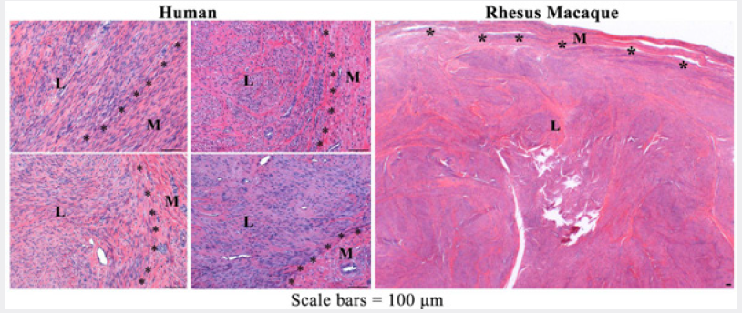 Click here to view Large Figure 1 Lupinepublishers-openaccess-Reproductive-Sexualdisorder