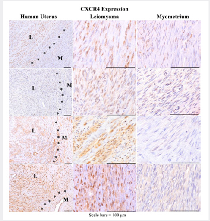Click here to view Large Figure 2 Lupinepublishers-openaccess-Reproductive-Sexualdisorder