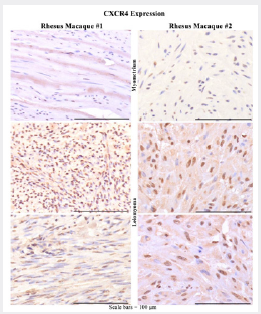Click here to view Large Figure 3 Lupinepublishers-openaccess-Reproductive-Sexualdisorder
