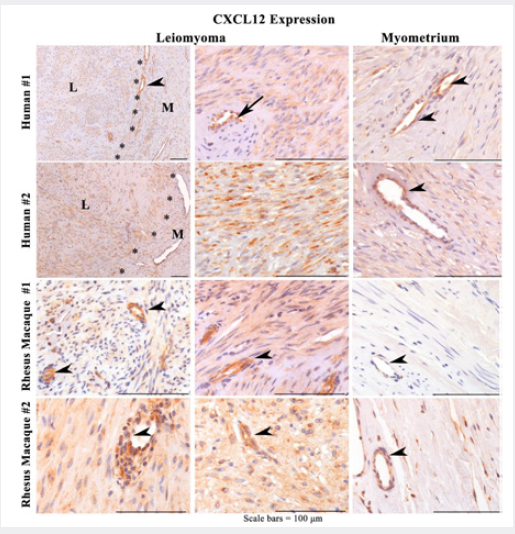 Click here to view Large Figure 4 Lupinepublishers-openaccess-Reproductive-Sexualdisorder