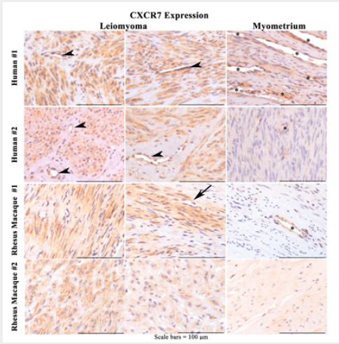 Click here to view Large Figure 5 Lupinepublishers-openaccess-Reproductive-Sexualdisorder