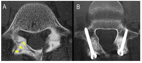 Click here to view Large Figure 3 Lupinepublishers-openaccess-Research-Reviews