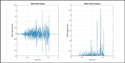 Click here to view Large Figure 10 Lupinepublishers-openaccess-biomedicalengineering-biosciences