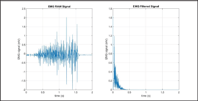 Click here to view Large Figure 11 Lupinepublishers-openaccess-biomedicalengineering-biosciences