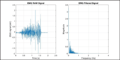 Click here to view Large Figure 12 Lupinepublishers-openaccess-biomedicalengineering-biosciences