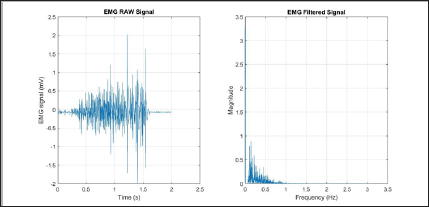 Click here to view Large Figure 14 Lupinepublishers-openaccess-biomedicalengineering-biosciences