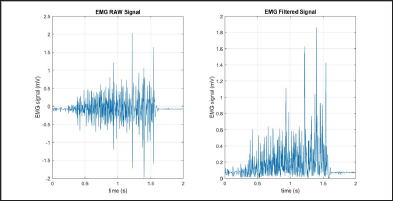 Click here to view Large Figure 5 Lupinepublishers-openaccess-biomedicalengineering-biosciences