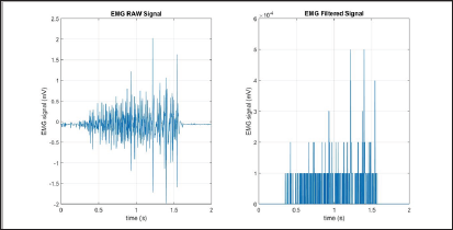 Click here to view Large Figure 6 Lupinepublishers-openaccess-biomedicalengineering-biosciences