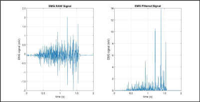 Click here to view Large Figure 7 Lupinepublishers-openaccess-biomedicalengineering-biosciences