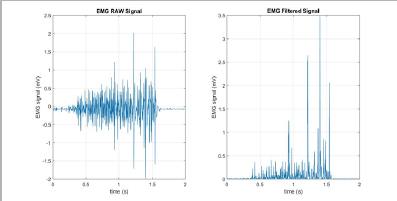 Click here to view Large Figure 9 Lupinepublishers-openaccess-biomedicalengineering-biosciences
