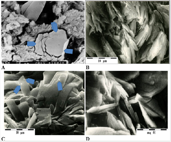 Click here to view Large Figure 1 Lupinepublishers-openaccess-cardiology