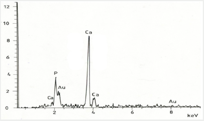 Click here to view Large Figure 2 Lupinepublishers-openaccess-cardiology