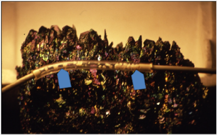 Click here to view Large Figure 8 Lupinepublishers-openaccess-cardiology