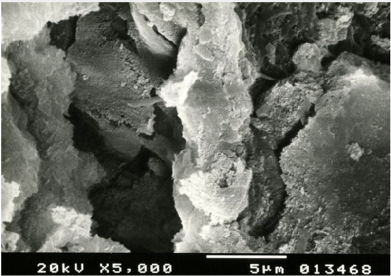 Click here to view Large Figure 9 Lupinepublishers-openaccess-cardiology