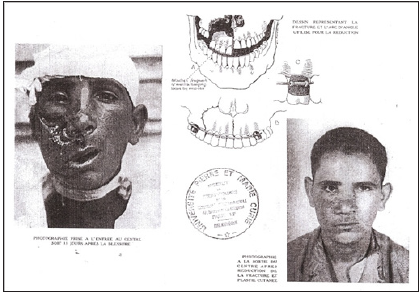 Click here to view Large Figure 11 Lupinepublishers-openaccess-dentistry-oral-healthcare