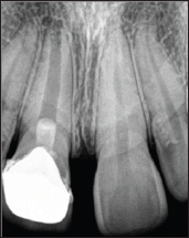 Click here to view Large Figure 1 Lupinepublishers-openaccess-dentistry-oral-healthcare
