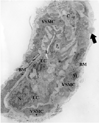 Click here to view Large Figure 4 Lupinepublishers-openaccess-dentistry-oral-healthcare