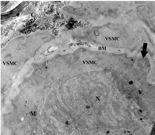 Click here to view Large Figure 5 Lupinepublishers-openaccess-dentistry-oral-healthcare