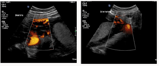 Click here to view Large Scheme 1 lupinepublishers-openaccess-journal-gynaecology-women-health-care