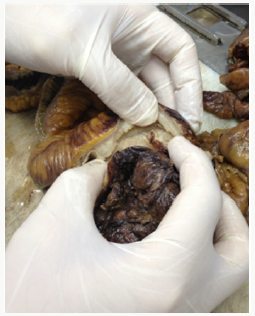 Click here to view Large Figure 2 Lupinepublishers-openaccess-biomedicalengineering-biosciences