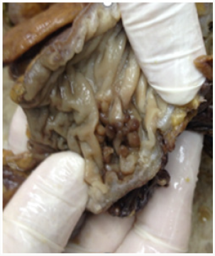 Click here to view Large Figure 4 Lupinepublishers-openaccess-biomedicalengineering-biosciences