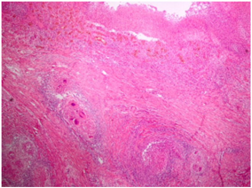 Click here to view Large Figure 5 Lupinepublishers-openaccess-biomedicalengineering-biosciences