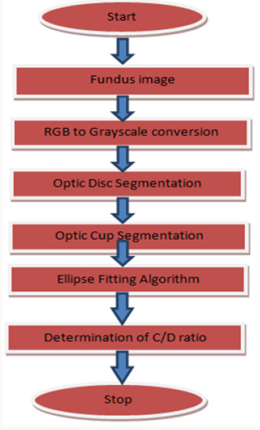 Click here to view Large Scheme 1 Lupinepublishers-openaccess-Ophthalmology