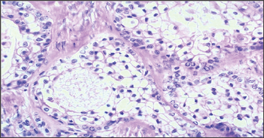 Click here to view Large Figure 3 lupinepublishers-openaccess-journal-pediatric-dentistry