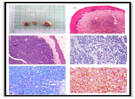 Click here to view Large Scheme 1 lupinepublishers-openaccess-journal-pediatric-dentistry