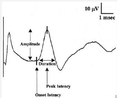 Click here to view Large Figure 3 Lupinepublishers-openaccess-journals-psychology-behavioral-science