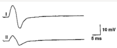 Click here to view Large Figure 5 Lupinepublishers-openaccess-journals-psychology-behavioral-science