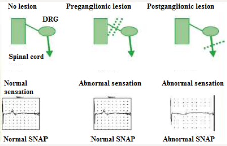 Click here to view Large Figure 6 Lupinepublishers-openaccess-journals-psychology-behavioral-science
