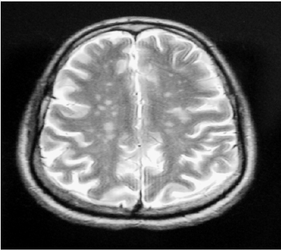 Click here to view Large Figure 1 Lupinepublishers-openaccess-journals-psychology-behavioral-science