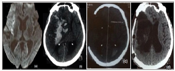 Click here to view Large Scheme 1 Lupinepublishers-openaccess-Research-Reviews